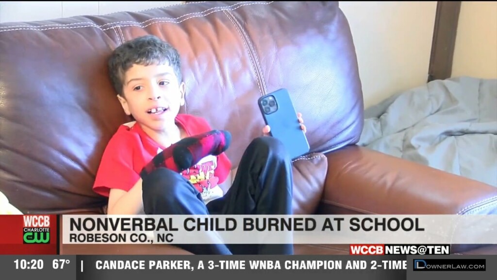 Nonverbal Child Burned At North Carolina School
