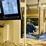 Atrium Health Sanger Heart Vascular Institute First In The Carolinas To Perform Innovative Coronary Procedure 1