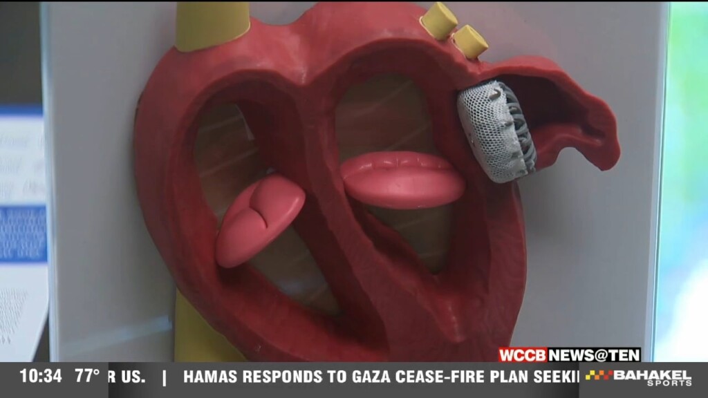 Afib Implant
