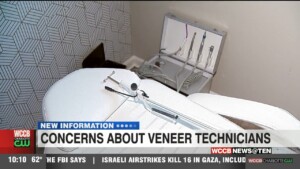 Concerns About Veneer Technicians