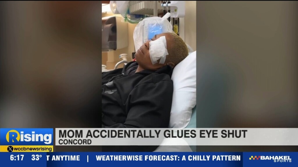 Concord Mom Accidentally Glues Eye Shut