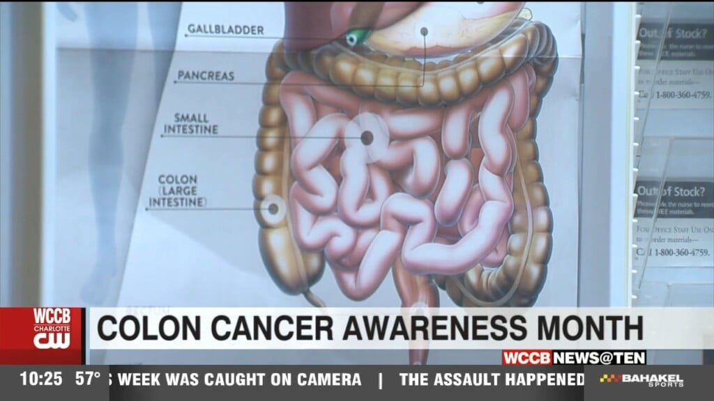 Rock Hill Man Urges Others To Get Screening After Colonoscopy Saved Him From Cancer Diagnosis