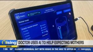 Doctors Use Ai To Help Expecting Mothers