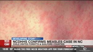 Measles In Nc