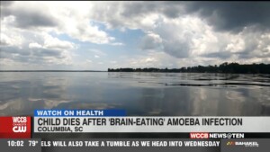 Child In Sc Dies From Brain Eating Amoeba
