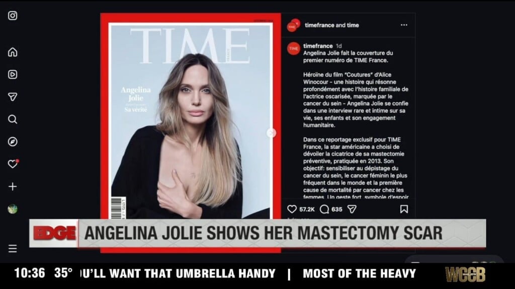 Angelina Jolie Shows Her Mastectomy Scars