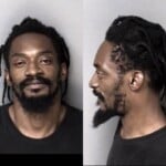 Markus Rice Injury Real Property