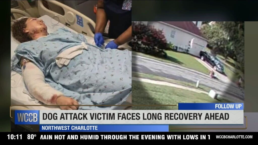 Multi Dog Attack Victim Faces Long Road To Recovery