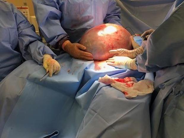 cyst1.jpg 