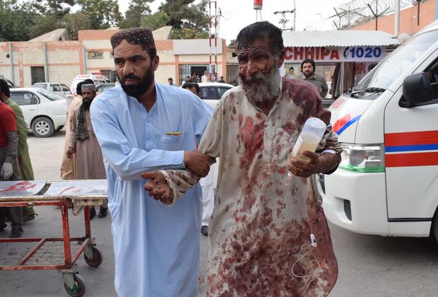 TOPSHOT - An injured Pakistani man is brought to a hospital in Quetta on July 13