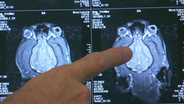 truffles-brain-scan-620.jpg 