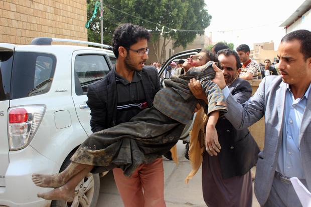 EDITORS NOTE: Graphic content / A Yemeni child is transported to a hospital after being wounded in a reported air strike on the Iran-backed Huthi rebels' stronghold province of Saada August 9