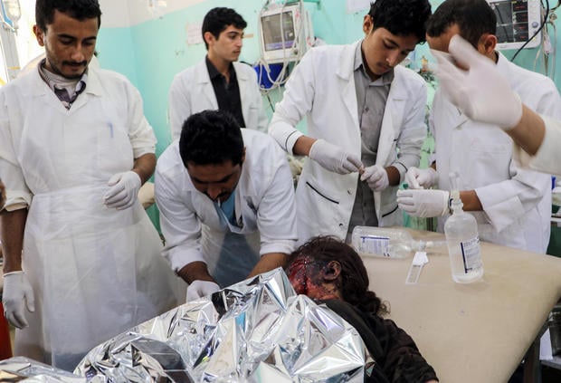 TOPSHOT - EDITORS NOTE: Graphic content / Medics treat a Yemeni child who was injured in a reproted air strike at an emergency clinic in the Iran-backed Huthi rebels' stronghold province of Saada on August 8