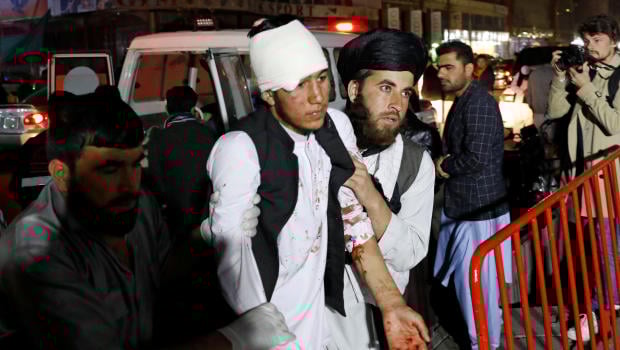 ATTENTION EDITORS - VISUAL COVERAGE OF SCENES OF INJURY OR DEATH Afghan men carry an injured person to a hospital after a suicide attack in Kabul