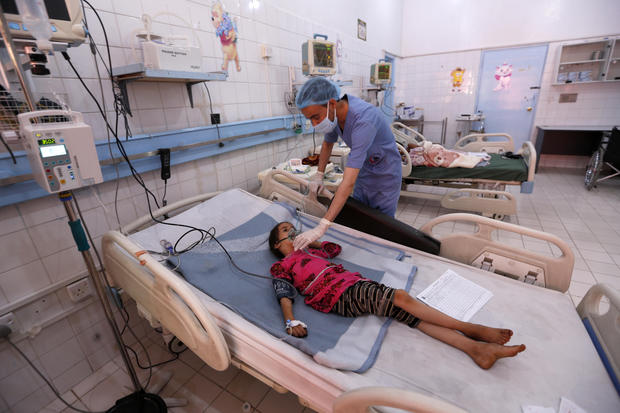 Yemeni children suffering from diphtheria receive treatment at a hospital in the capital Sanaa on November 22