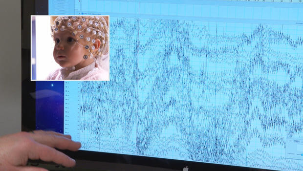 vaccines-baby-eeg-620.jpg 