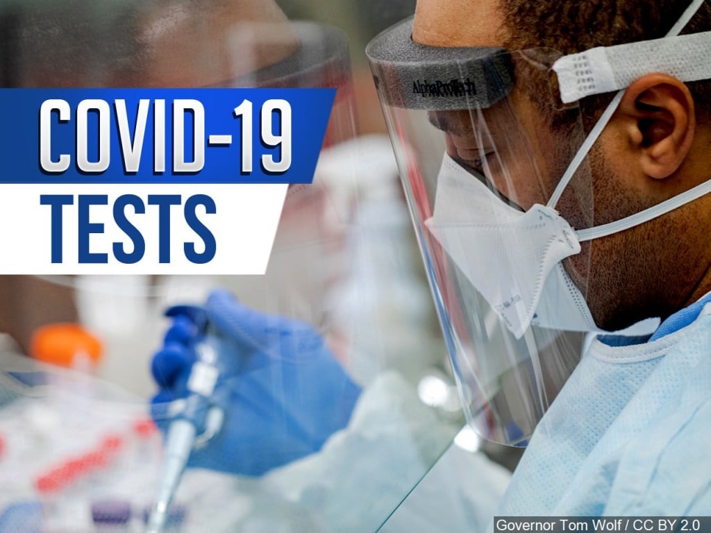 Coronavirus COVID-19 Tests