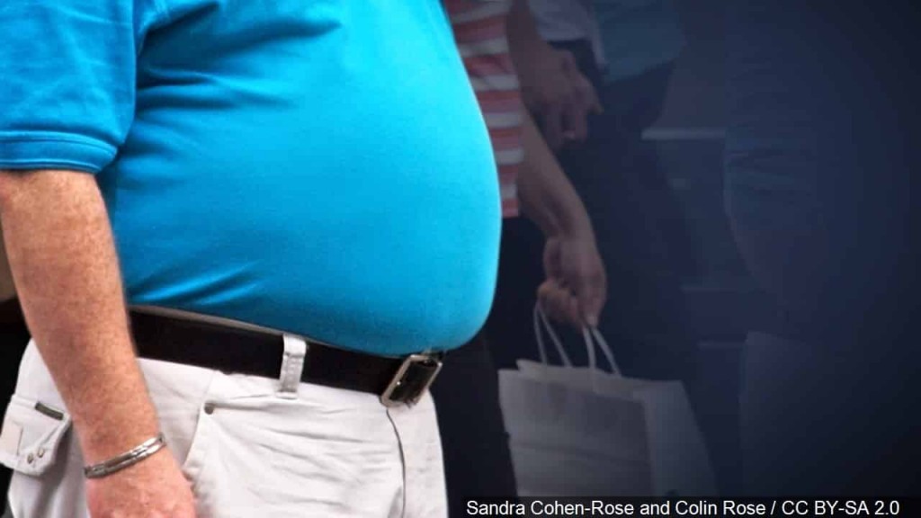 obesity