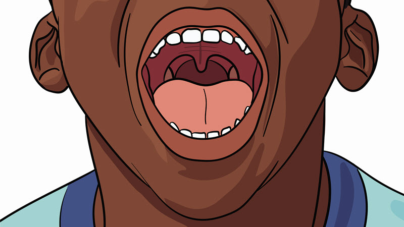 Strep Throat Normal Throat