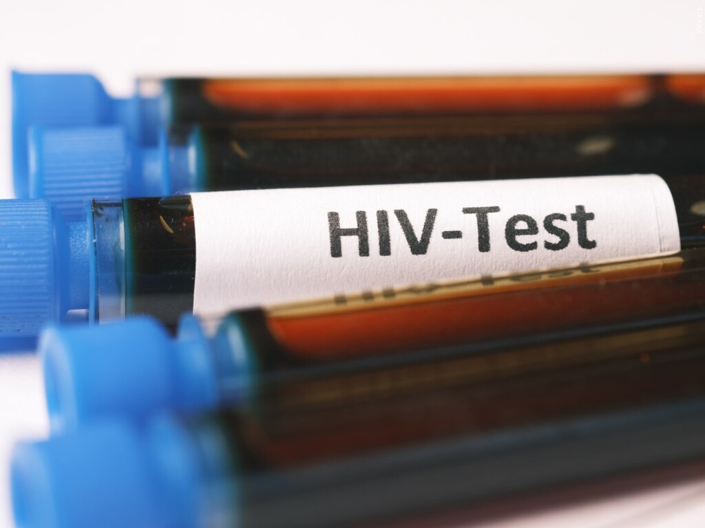 HIV test / MGN