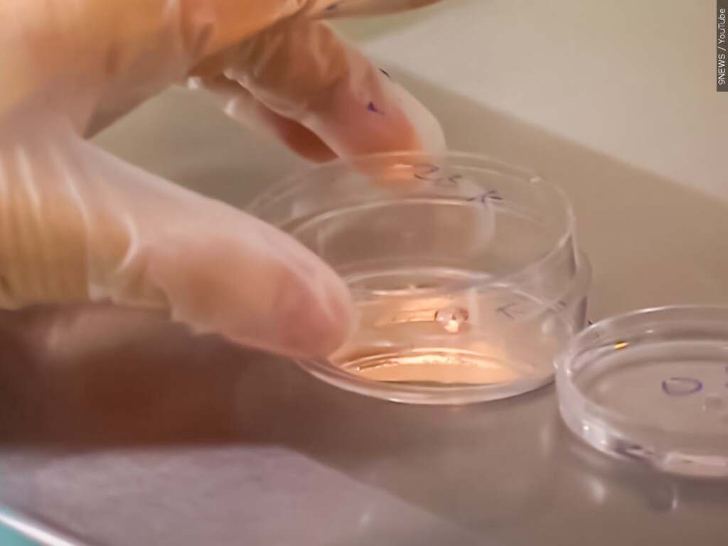 Ivf