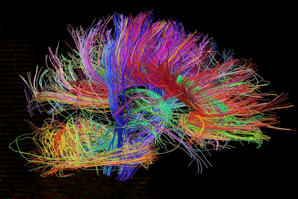 What is brain mapping? WFXB