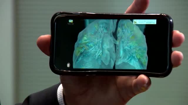 Dc: Covid: Inside Infected Lungs