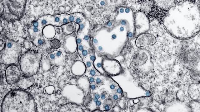 Coronavirus: The U S Is Now The Epicenter