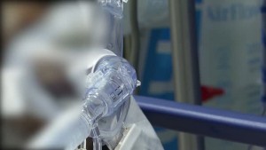 Covid: U S Death Totals May Be Higher Says Cdc