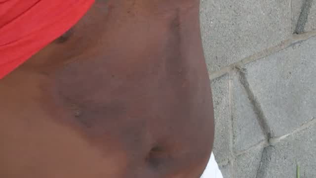 Ks: Man Burned By Firework Shot Into His Car