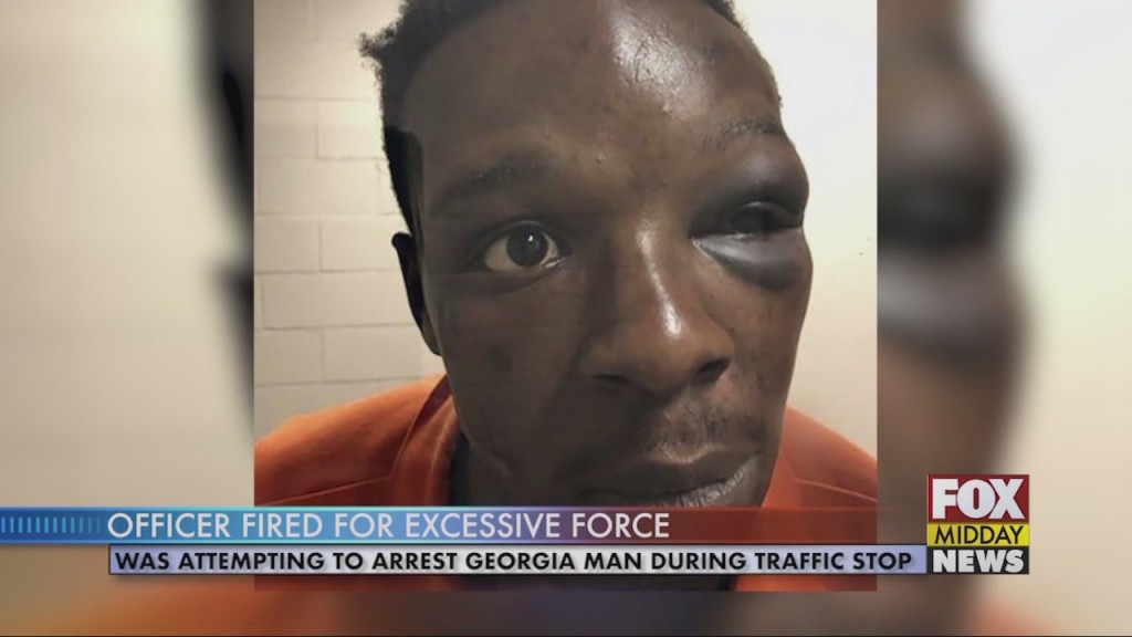 Man Beaten