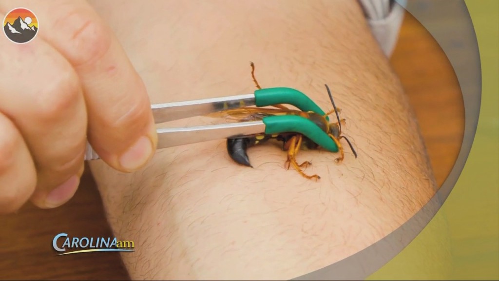 Insect Stings