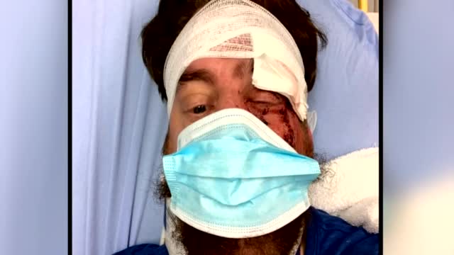 Wa: Covid: Man Attacked By Non Mask Wearers
