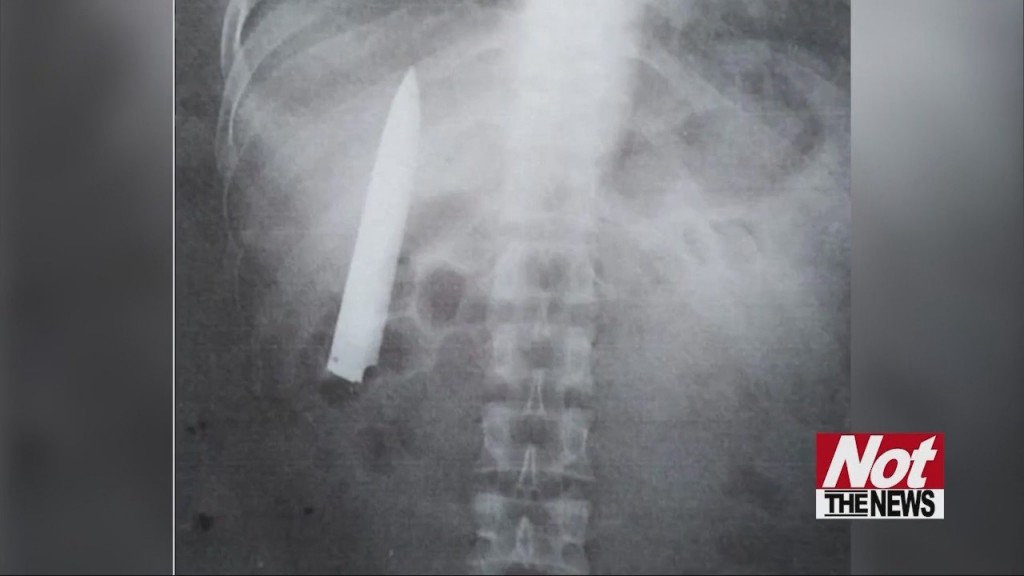 Knife In Man
