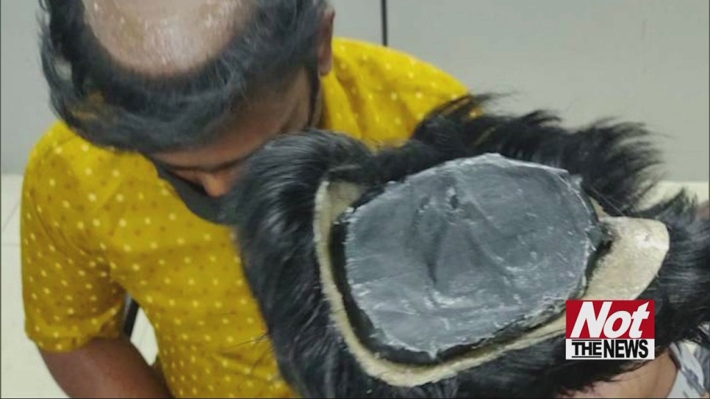 Toupee