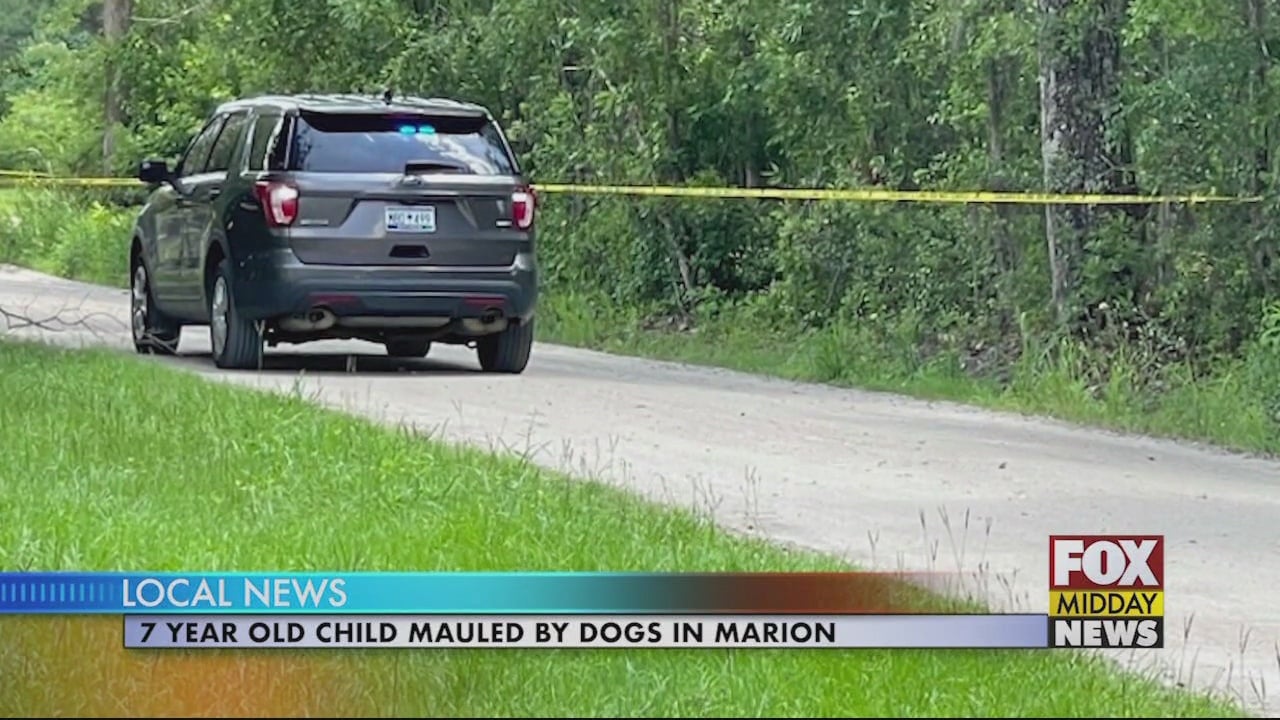 7 Year Old Child Dies After Being Mauled By Dogs In Marion - WFXB
