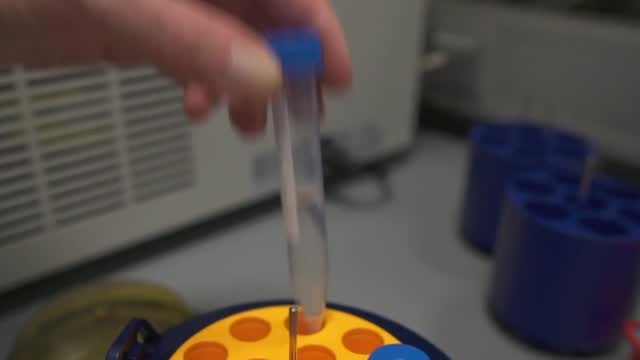Investigation Into Rare Nerve Syndrome Linked To J&j Vaccine