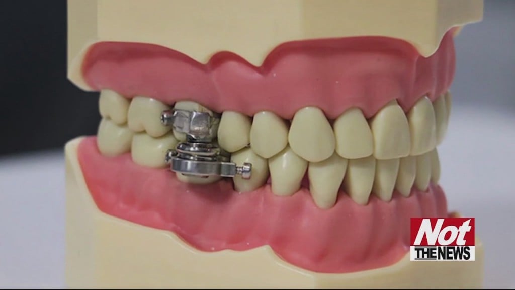 Teeth Contraption
