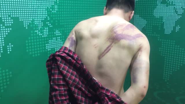 Afghanistan: Journalists Brutalized By Taliban