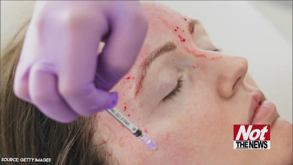 Vampire Facial