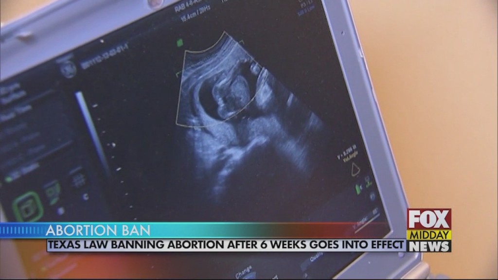 Abortion