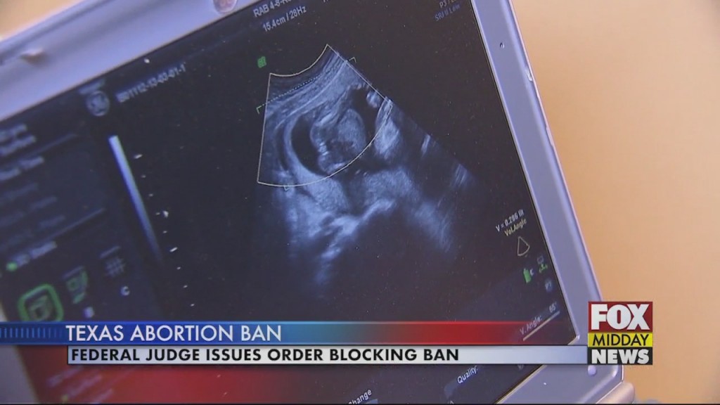 Abortion