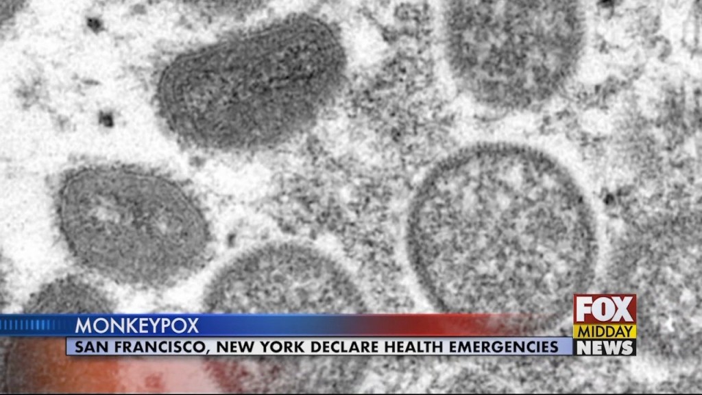 Monkeypox