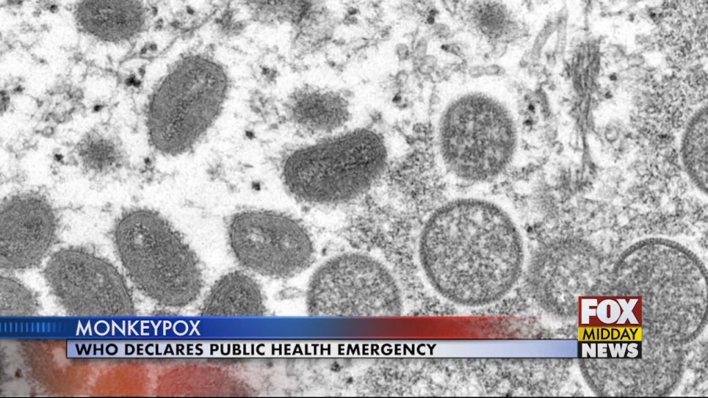 Monkeypox