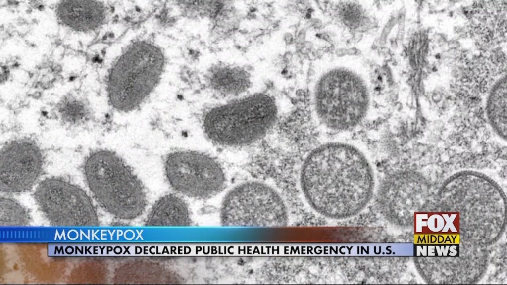 Monkeypox