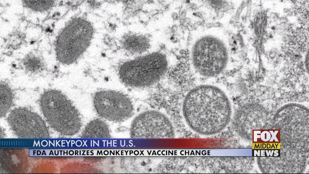 Monkeypox