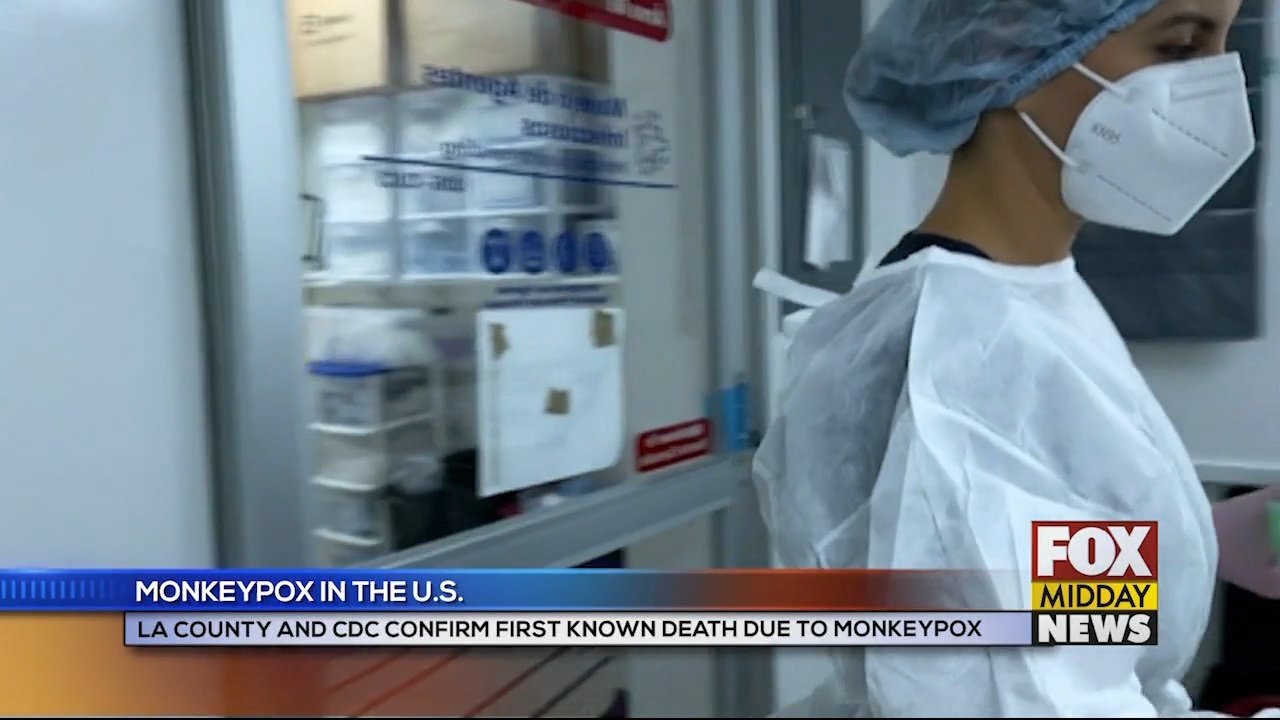 CDC Confirms First Known Death Due to Monkeypox in the U.S. - WFXB