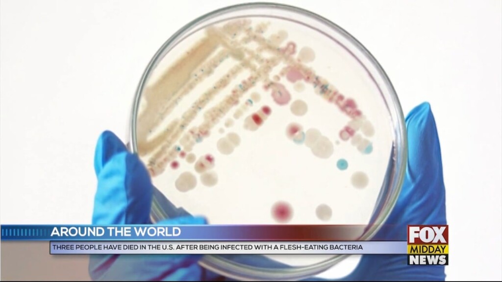 Bacteria