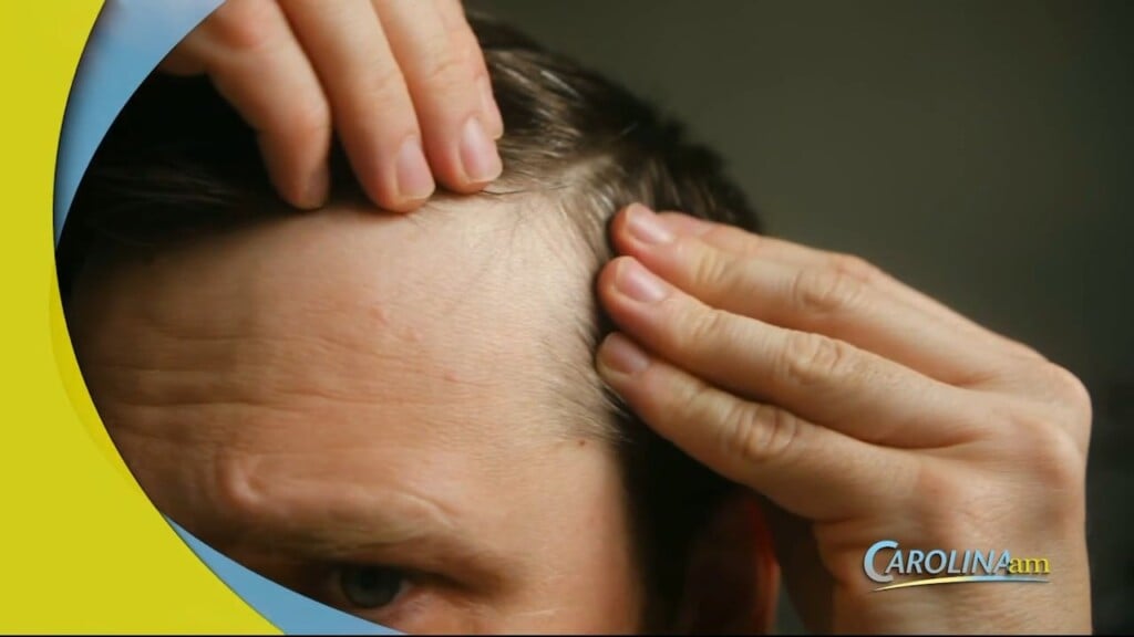 Hair Loss