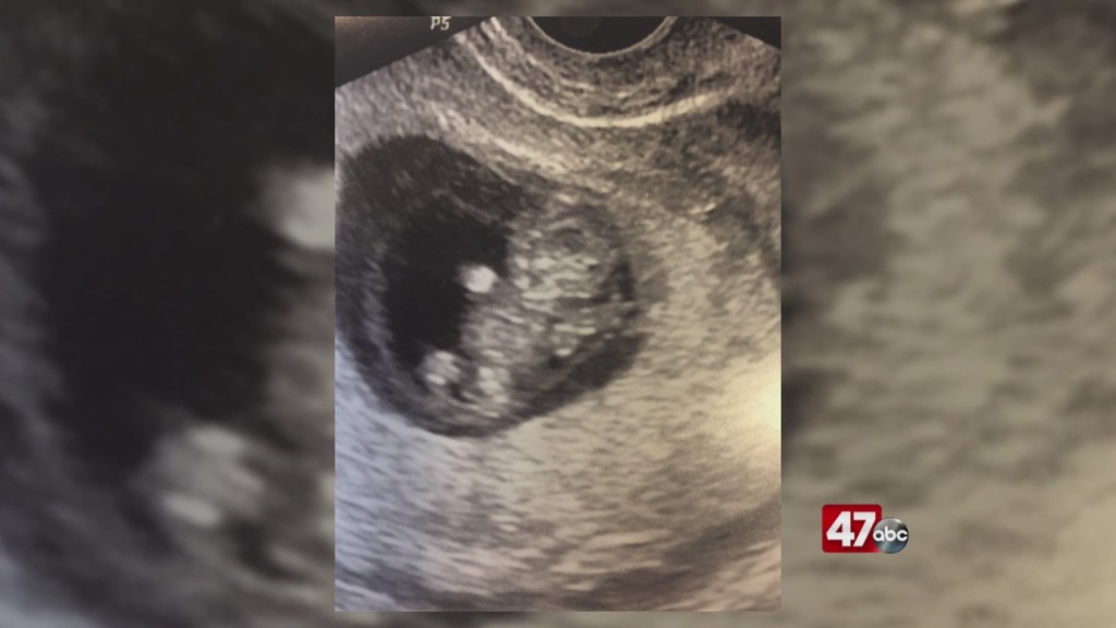 Pregnant Women Adjust Amid Coronavirus